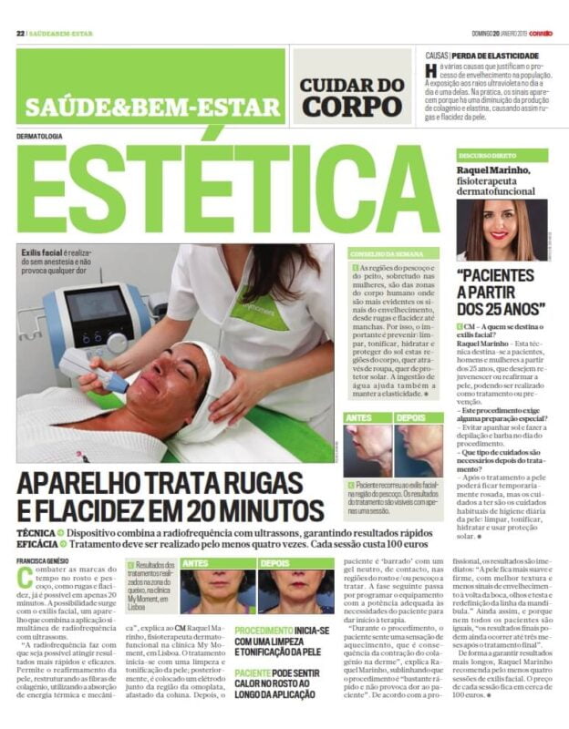 Exilis Facial Tratamento de Radiofrequência na My Moment