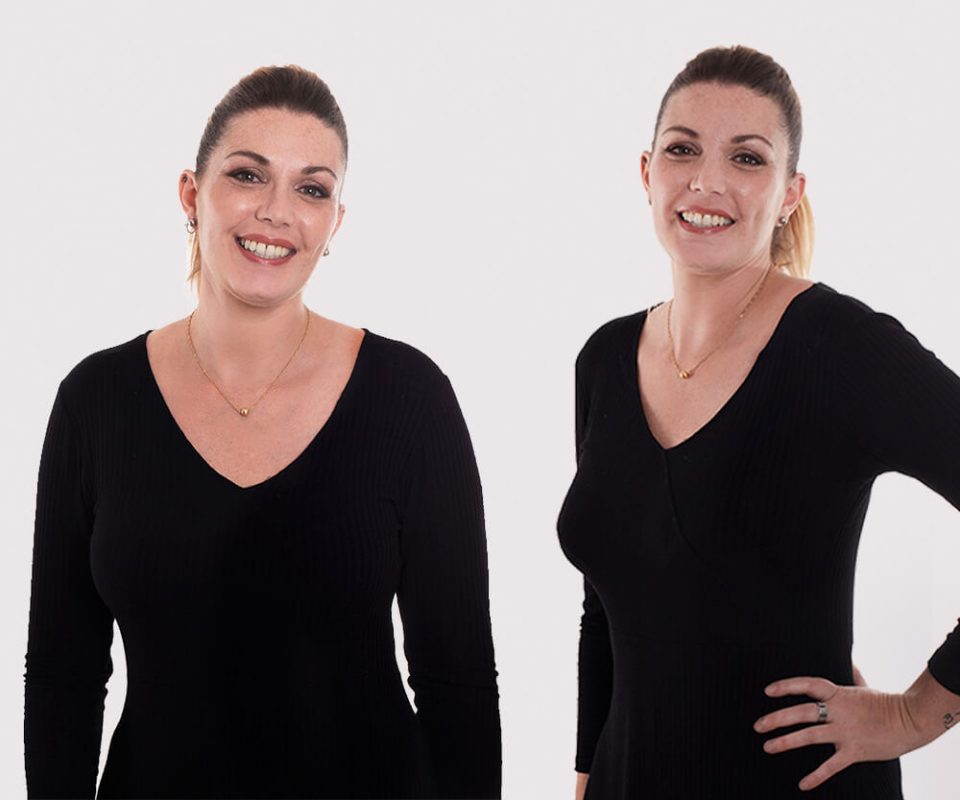 Mommy Makeover - Casos TV - Programa Cristina