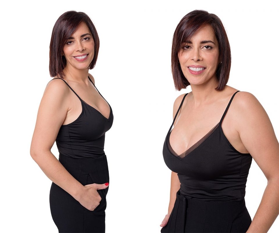 Mommy Makeover - Casos TV - Programa Cristina