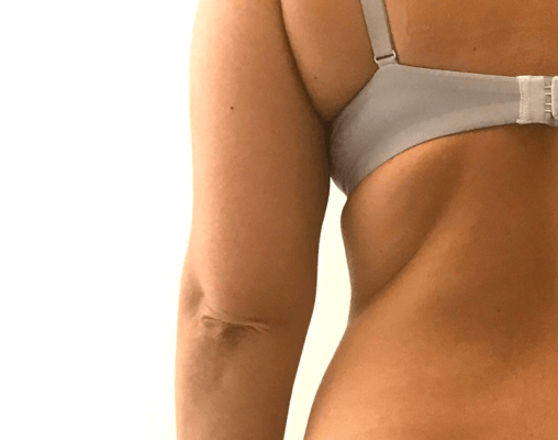 Antiaging, costas de senhora