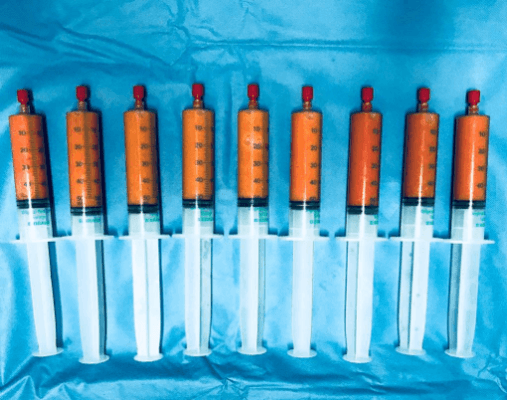 Lipofilling: aumento de glúteos e elevação da autoestima