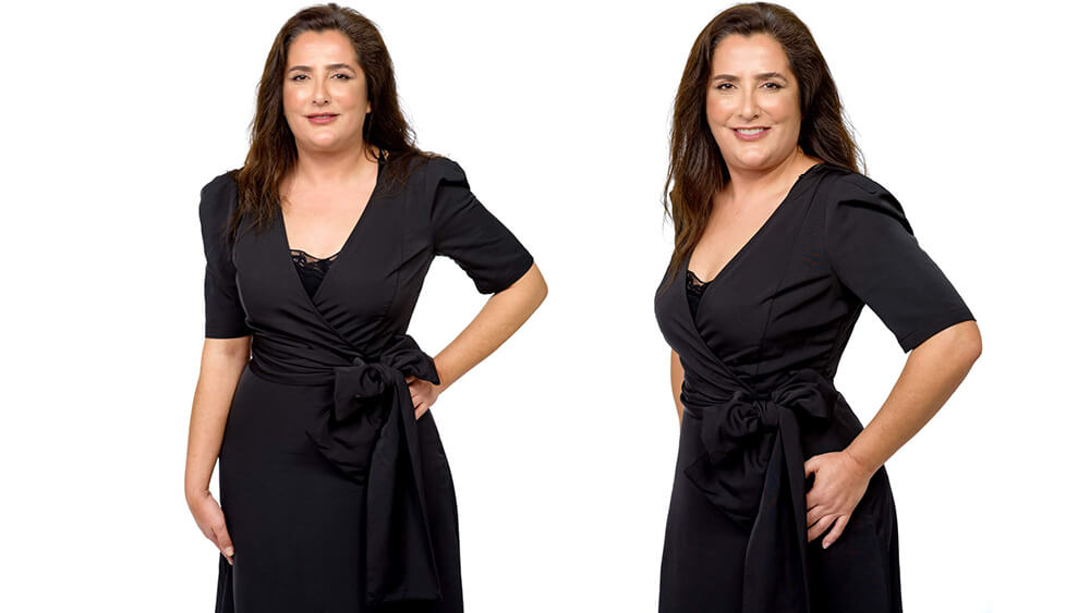 Mommy Makeover - Casos TV - Programa Cristina